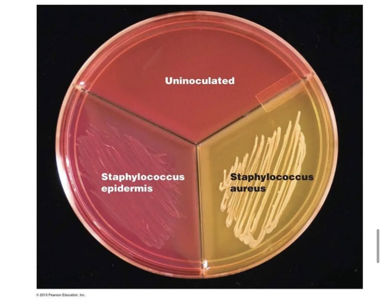 <p>Interpret the data above. The plate is Mannitol Salt agar. What can you determine about Staphylococcus aureus compared to Staphylococcus epidermidis?</p>