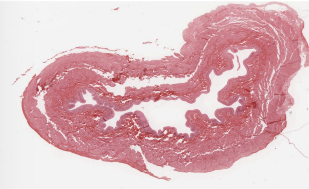 <p>What organ is shown in the picture?</p>