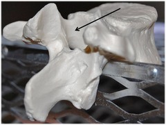 <p>Name this specific part of the lumbar vertebra.</p>