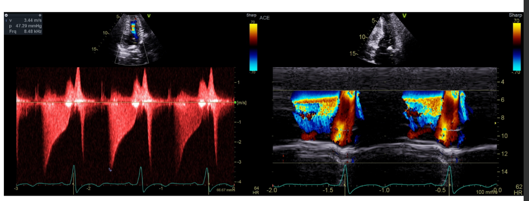 <p>explain what the m-mode is showing</p>