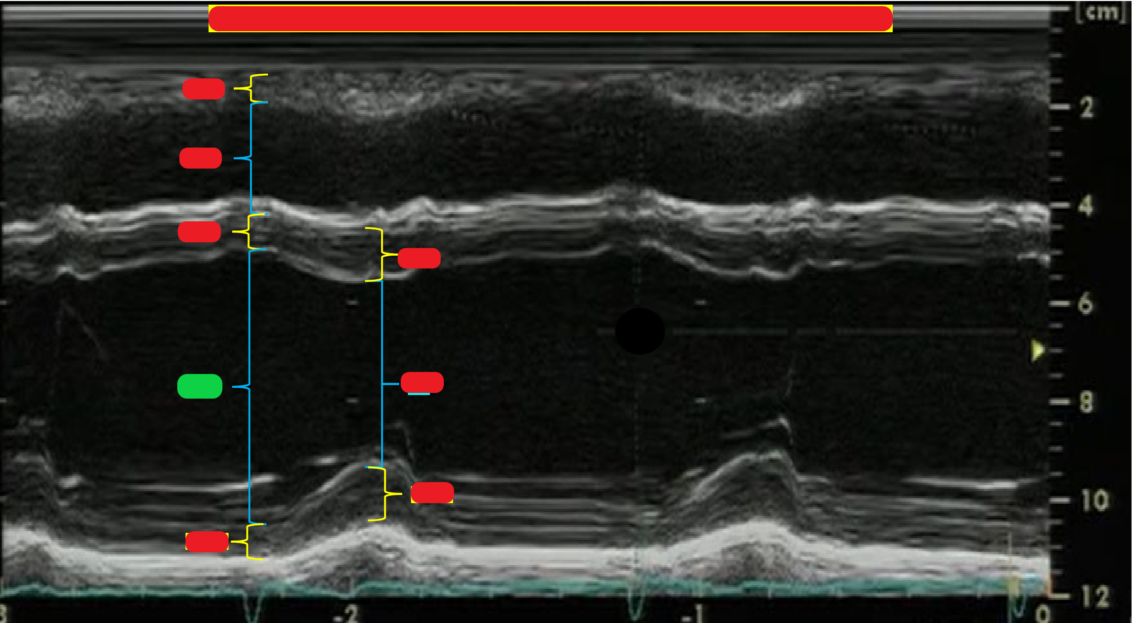 <p>What is highlighted in green?</p>