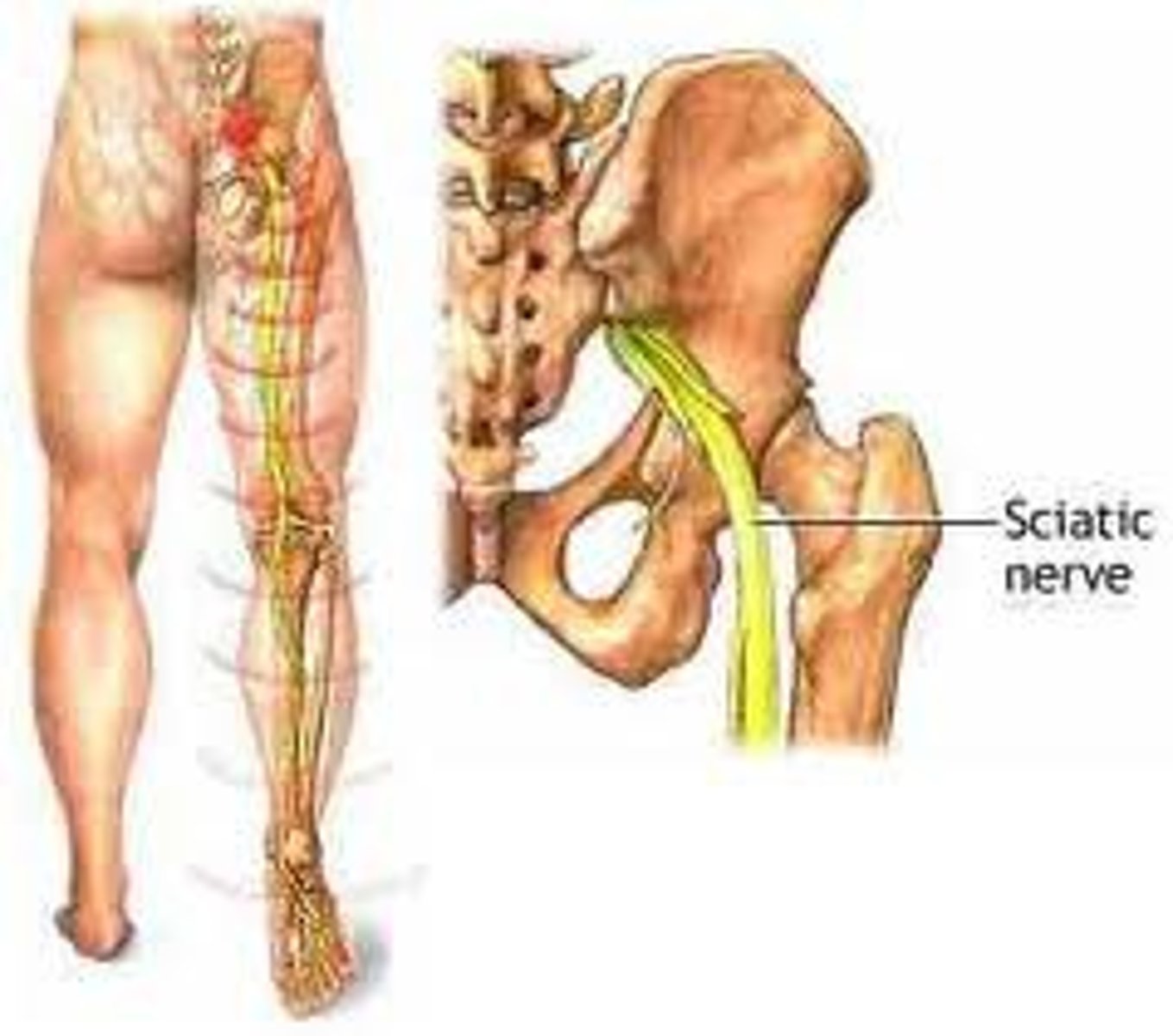 <p>largest nerve in the body</p>