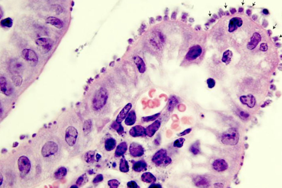<p>Patient avec colite </p><p>1) diagnostic </p><p>2) Histologie </p><p>3) colorations </p>