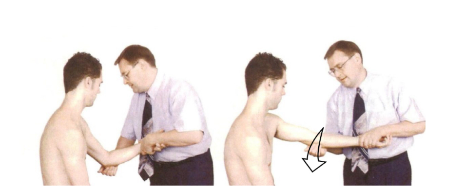 <p>ABd with medial glide </p><ol><li><p>Pt seated, physician in front of pt</p></li><li><p>Thumb under medial epicondyle and thenar eminence will act as fulcrum</p></li><li><p>Other hand holds wrist to ADd and slight extension</p></li><li><p>Thrust on both hands. Olecranon goes lateral, wrist goes medial</p></li></ol><p></p><p>ADd with lateral glide</p><ol><li><p>Pt seated</p></li><li><p>Thumb on lateral aspect of olecranon and extend elbow slightly </p></li><li><p>Abduct forearm into barrier</p></li><li><p>Thrust is olecranon goes medial and wrist lareral.</p></li></ol><p></p>