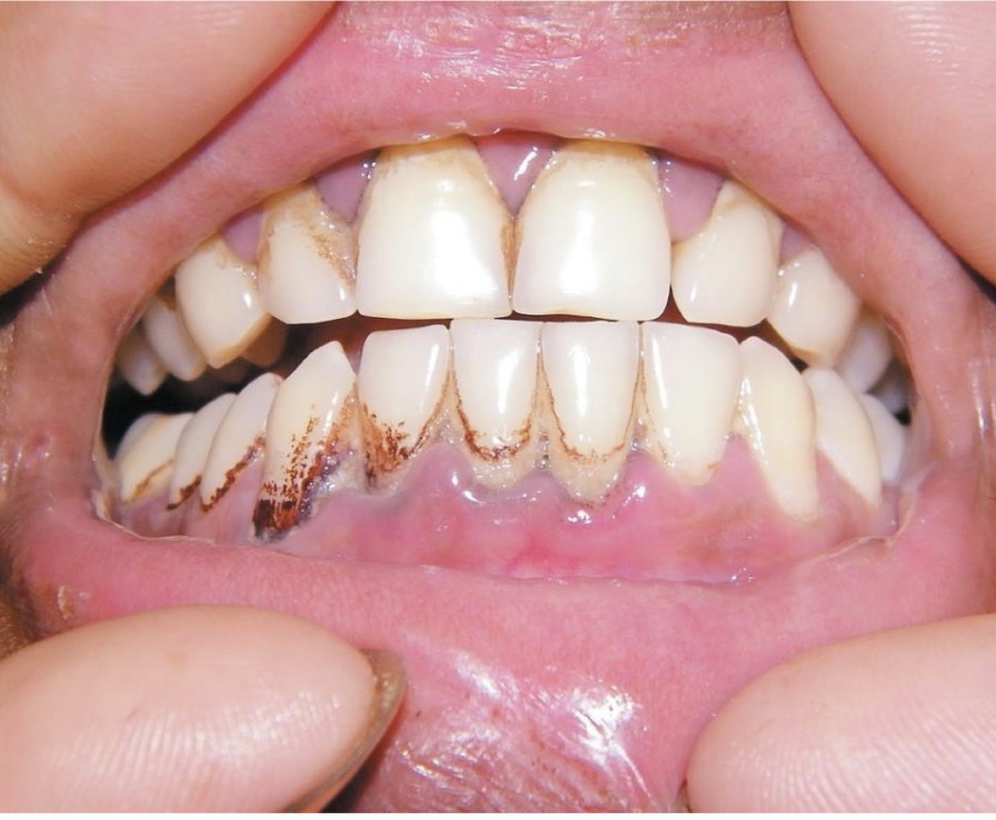 <p>CHẨN ĐOÁN</p>