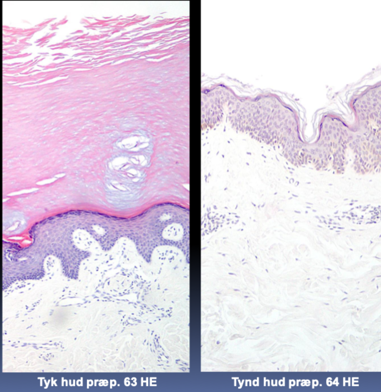 <p>Hvilket epidermislag findes kun i tyk hud? </p>