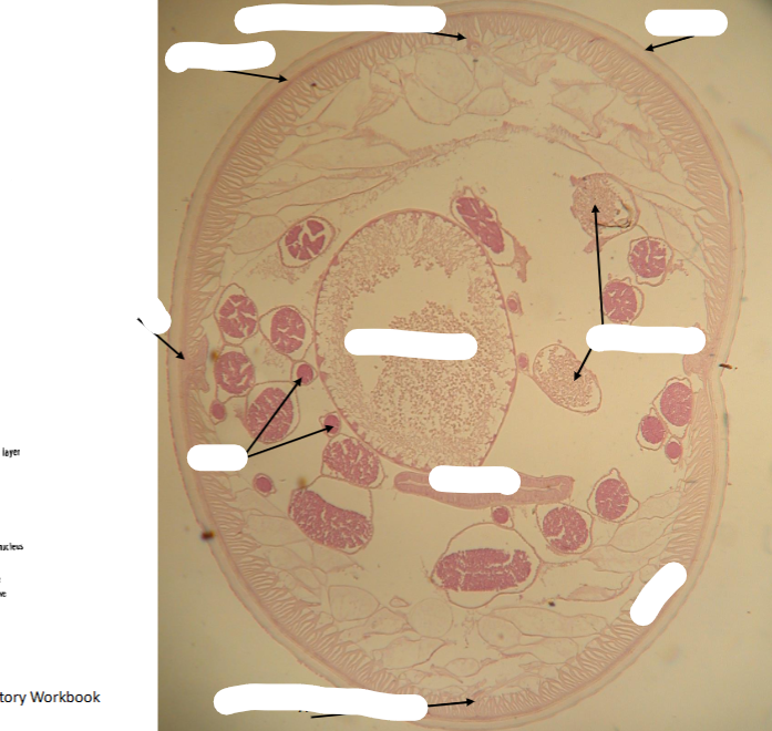 <p>What is this parasite and what are the structures </p>