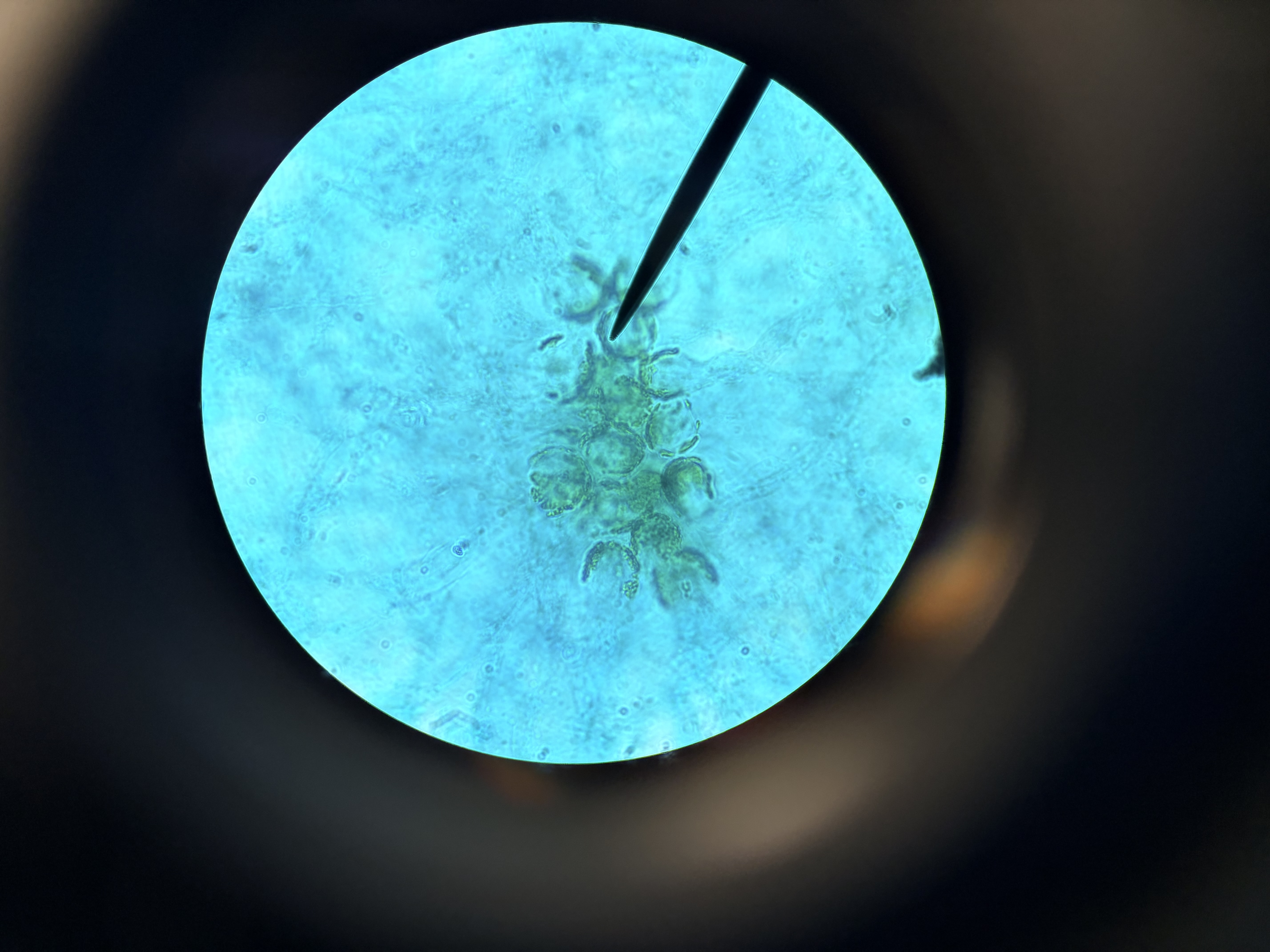 <p>*What fungi is this</p>