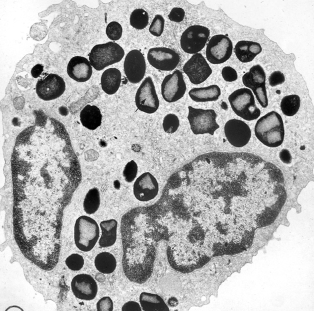 <p>Eosinophil</p><p></p><p>dual-colored specific granules</p><p>bi-lobed nucleus</p>