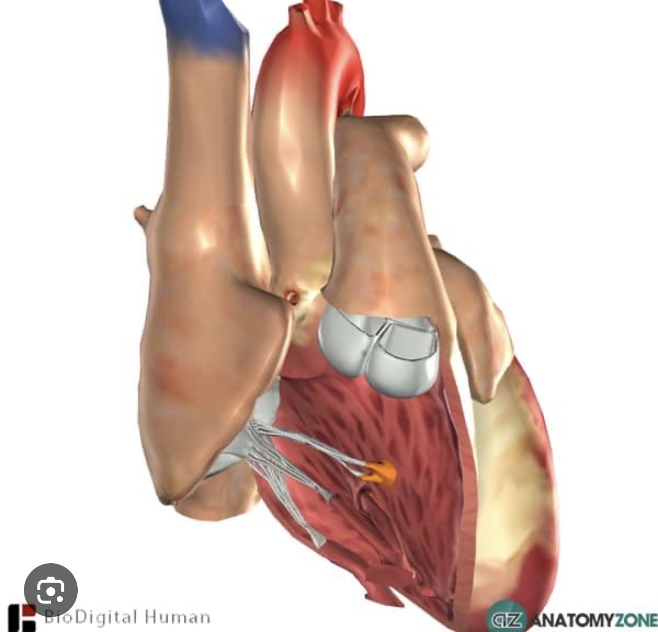 <p><span><span>cone-shaped muscles in the ventricles that attach to the chordae tendineae and contract to prevent atrioventricular valves from inverting during ventricular contraction.</span></span></p>