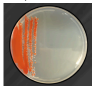 <p><span style="background-color: transparent;"><strong>What problem in streaking technique most likely produced the plate shown?&nbsp;</strong></span></p><p><span style="background-color: transparent;"><strong>Answer choices for all examples</strong></span></p><p><span style="background-color: transparent;">A. Failure to flame loop between sections</span></p><p><span style="background-color: transparent;">B. Crossing back into previous section on every streak</span></p><p><span style="background-color: transparent;">C. Forgetting to cross into first section on second streak</span></p><p><span style="background-color: transparent;">D. Forgetting to cross into second section on third streak</span></p><p><span style="background-color: transparent;">E. Not letting the loop cool before taking sample from tube </span></p><p><span style="background-color: transparent;">(Lecture #1-2 Questions)</span></p>