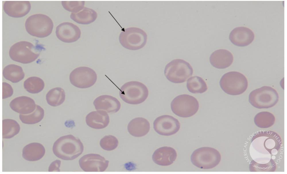 <p>What is this RBC shape?</p>