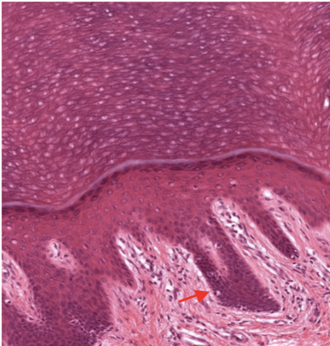 <p>Identify the layer of the skin</p>