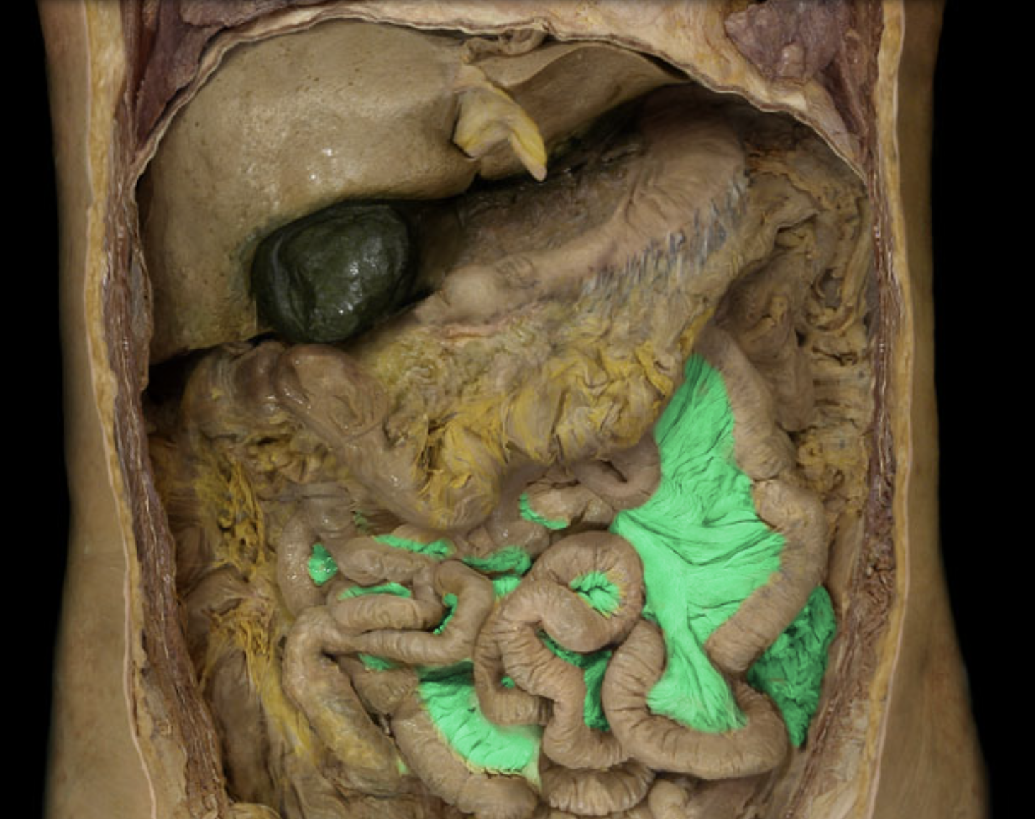 term image