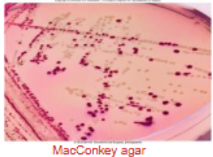 <p>inhibit growth of unwanted organisms</p><ul><li><p>allow only sought after organisms to grow </p></li></ul><p>ex.</p><ul><li><p>Thayer-Martin agar</p><ul><li><p>for isolation of <em>Neisseria gonorrhoeae</em> </p></li></ul></li><li><p>MacConkey agar</p><ul><li><p>for isolation of Gram-negative bacteria </p></li></ul></li></ul><p></p>