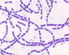 <p>Ulcerating pustule, asia, animal hides</p>
