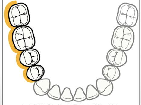 <p>What aspect is this?</p>