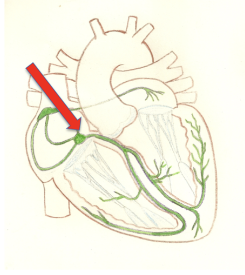 <p>Located in the inferior segment and receives input from SA node. Slow signal due to fewer gap junctions </p>