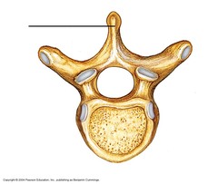 <p>Category: Typical Vertebra</p>