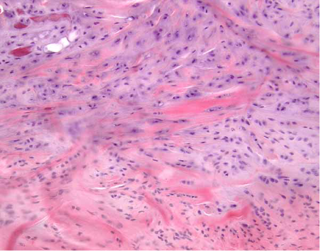 <p>intervertebral discs</p>