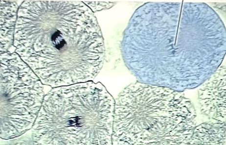 <p>Identify the stage of mitosis at the pointer</p>
