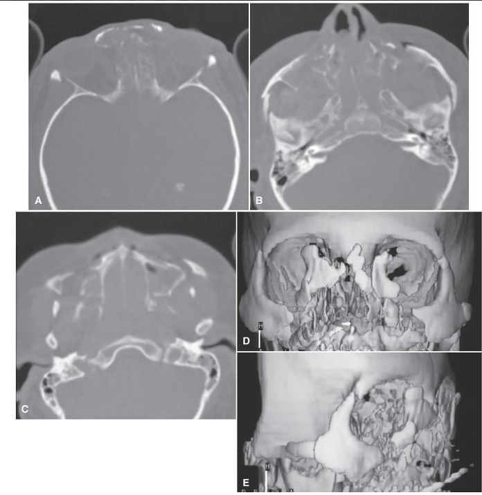 term image