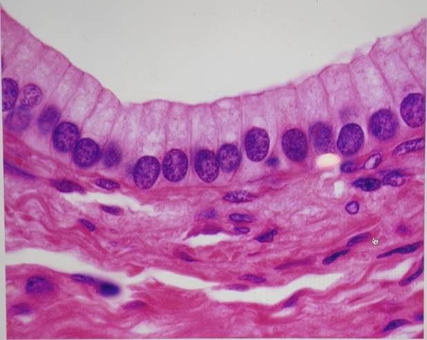 <p>Identify the SPECIFIC type of tissue (NOT epithelial/connective/muscle/nervous categories) shown in the image below.</p>