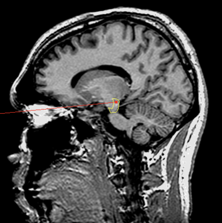 <p>What is the area highlighted called?</p>