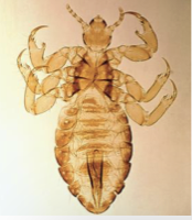 <ul><li><p>human body louse </p></li><li><p>pediculosis</p></li></ul><p></p>