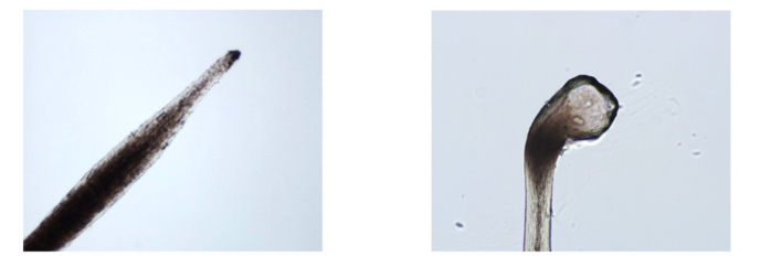 <p>Which phases of growth are these hairs in?</p>