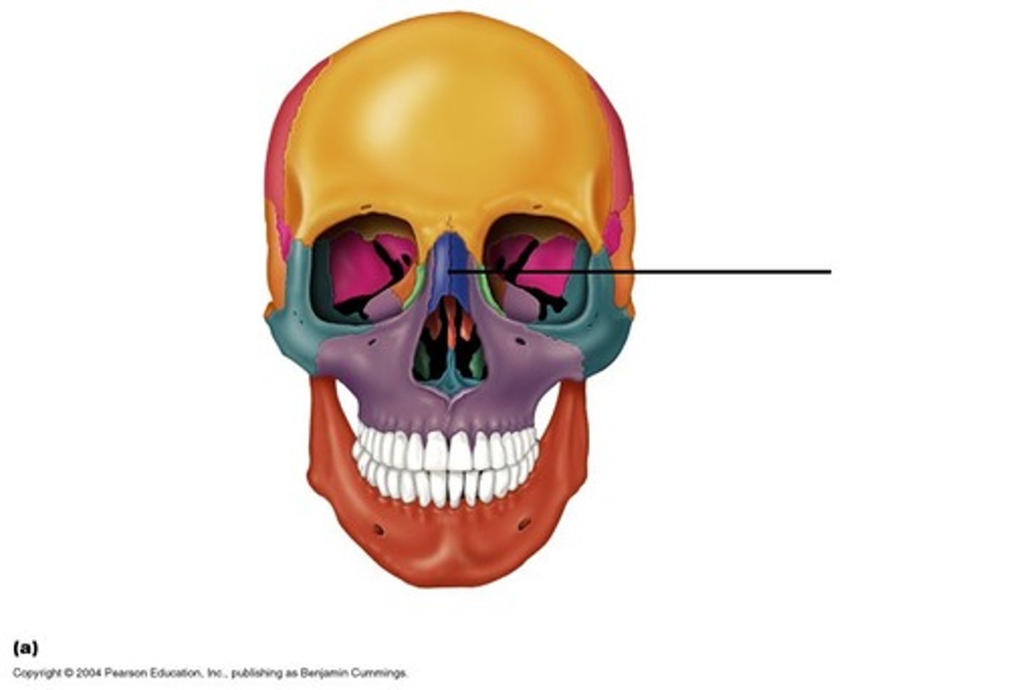 <p>ID bone at arrow</p>