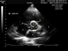 <p>What is structure 6?</p>