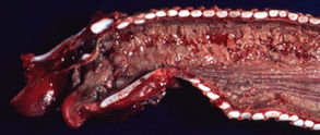 <p>diagnostico etiologico </p>