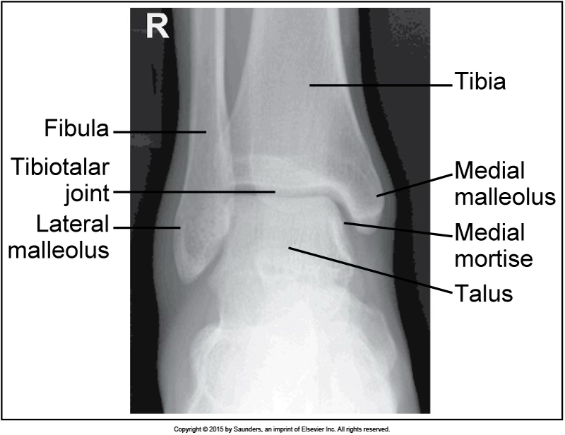<p>AP ankle</p>