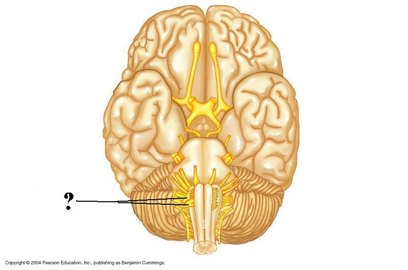 <p>Identify the indicated cranial nerve</p>
