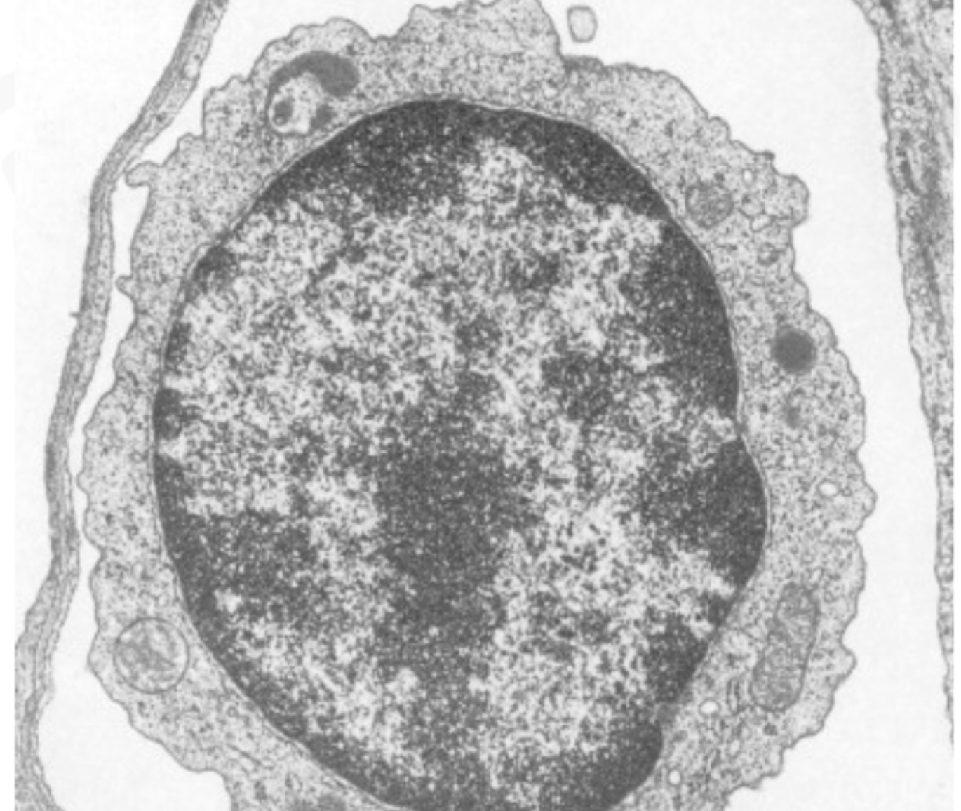 <p>Plasma Cell (specialized lymphocyte)</p><p>Produces antibodies and has eccentric nuclei with "clock-face" chromatin</p><p></p><p>Lymphocyte photo → makes antibodies + condensed chromatin</p>