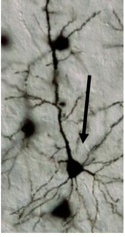 <p>Pyramidal Cell</p>