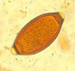 <p>Identifique e cite a forma de contágio</p>