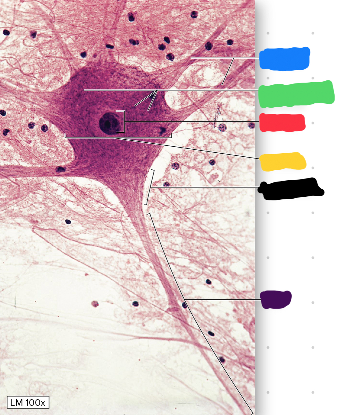 <p>what is the yellow blank pointing to on the neuron</p>