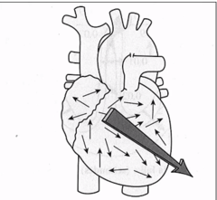 <p>- tās virzienu nosaka kambaros</p><p>- tas ir summārais elektriskais impulss (kādā virzienā tas dodas)</p><p>- palīdz diagnosticēt patoloģijas</p>