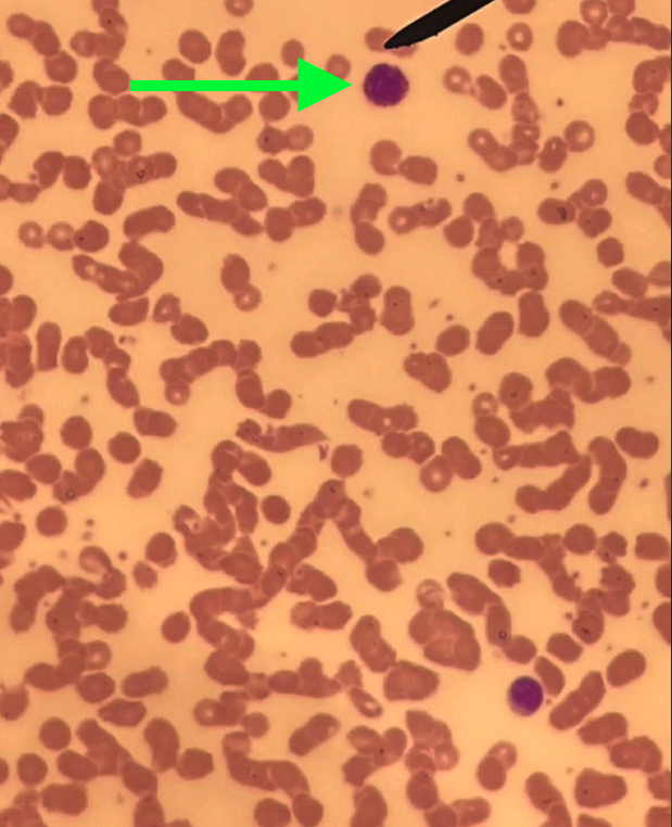 <p>Tế bào gì ?</p>