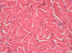 <p>fibers are in randomized directions; increases strength when pulled in multiple directions, less in one direction</p><p>- able to withstand tension exerted in MANY directions; provides structural strength.</p><p>- dermis of the skin, submucosa of digestive tract; fibrous capsules of organs and of joints</p>