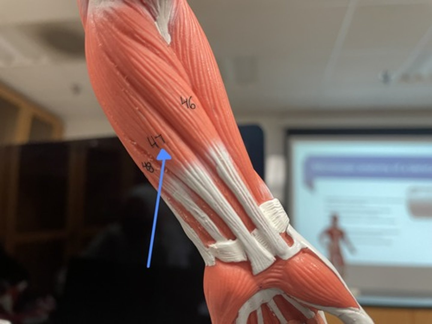 <p>palmaris longus</p><p>origin:</p><p>insertion:</p><p>action:</p>