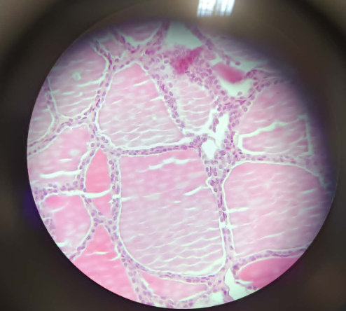 <p>Glandula Thyroidea Simple Cuboidal Epithelium - HE (2)</p><ul><li><p>Endocrine gland = hormones (iodine based)</p></li><li><p>built of follicles</p></li><li><p>on top of basal membrane = simple cuboidal epithelium (nucleus = circle)</p></li><li><p>looks like 2 layers of cells</p></li><li><p>colloid content - pre-hormones, iodine ions, and hormones</p></li></ul><p></p>