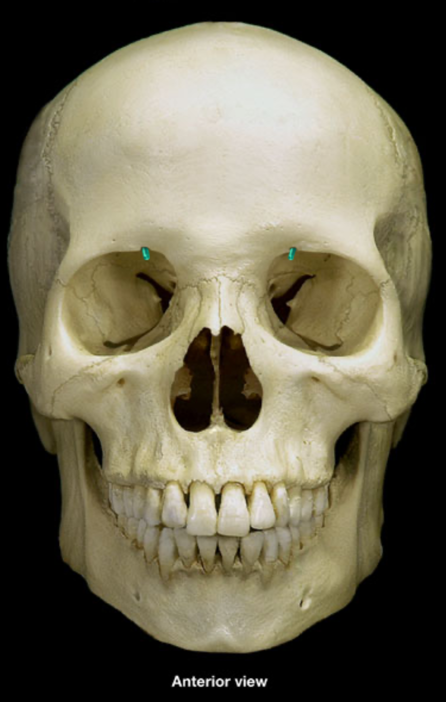 term image
