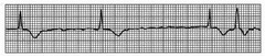 <p>Which rhythm is this?</p>