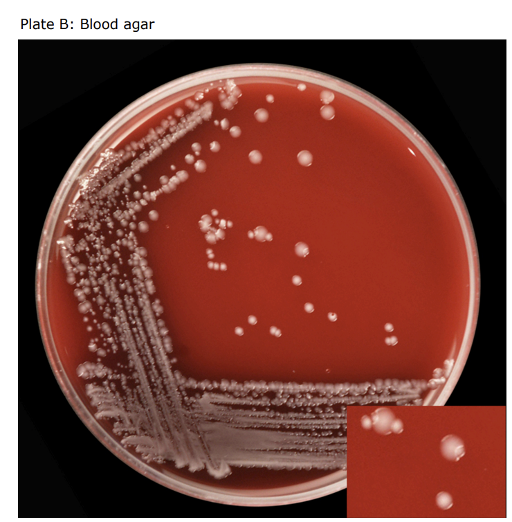 <p>USE OF INDICATOR MEDIUM: CULTURE FROM A FAECAL SWAB</p>
