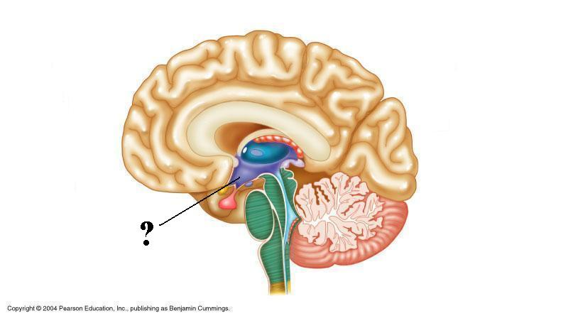 <p>Identify the indicated structure of the brain</p>