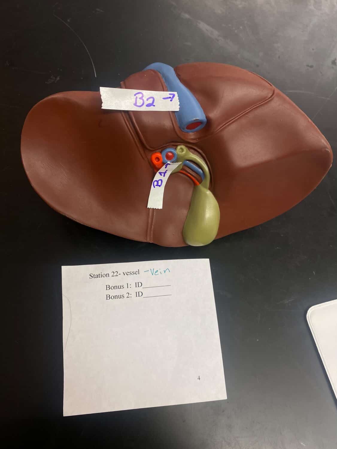 <p>b2</p>