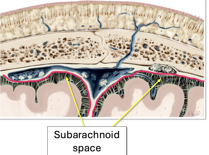 <p>Deep to Dura but superficial to pia mater </p>